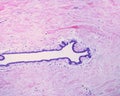 Human breast gland. Lactiferous duct