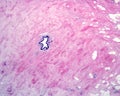 Human breast gland. Lactiferous duct