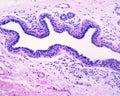 Human breast gland. Lactiferous duct