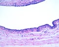 Human breast gland. Lactiferous duct