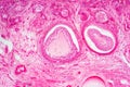 Light microscopic of human ovary showing primary and secondary follicles Royalty Free Stock Photo