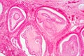 Light microscopic of human ovary showing primary and secondary follicles