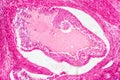 Light microscopic of human ovary showing primary and secondary follicles Royalty Free Stock Photo