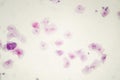 Light photomicrograph of buccal smear