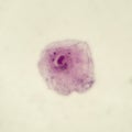 Light photomicrograph of buccal smear