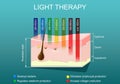 Light therapy. Phototherapy or laser therapy