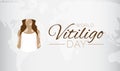 Light World Vitiligo Day Background Illustration Royalty Free Stock Photo