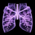 Lilac X-ray Image Of Human Lungs In Layered Translucency Royalty Free Stock Photo