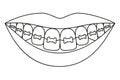 Line art black and white healthy smile in braces