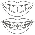 Line art black and white teeth aligning concept