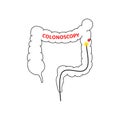 Linear colonoscopy procedure sign