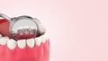 Lingual braces system on a demonstration denture 3d close up on color gradient Royalty Free Stock Photo