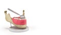 Lingual braces system on a demonstration denture 3d render on white Royalty Free Stock Photo