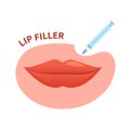 Lip filler plumping augmentation with beauty injection Royalty Free Stock Photo