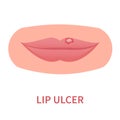 Lip ulcer blister inflammation outbreak medical icon