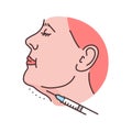 Lipolytic injections into the chin color line illustration