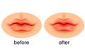 Lips are dry and after moistening Royalty Free Stock Photo