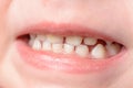 Little baby`s teeth are shot at the macro when she laughs Royalty Free Stock Photo