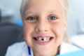 Little blond happy kid girl at dentist office smiling showing diastema overbite teeth missing gap. Child during