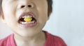 Little boy biting yellow candy.