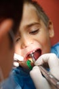 Little boy at dentist Royalty Free Stock Photo