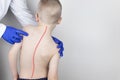 A little boy at the doctor`s appointment with back pain. Treatment of spinal deformity and stoop. Osteoporosis, kyphosis, lordosi