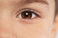 Little boy, focus on eye. Visiting children`s doctor Royalty Free Stock Photo