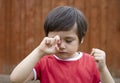 Little boy is having allergy rubbing his eye, Kid scratching his eyes while playing outdoor in summer, Child having allergy itchy Royalty Free Stock Photo