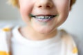 Little boy is learning carefully brush teeth. Child using liquid for disclosing plaque. Teaching children proper oral hygiene.