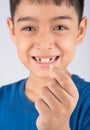 Little boy showing baby teeth toothless close up waiting for new teeth Royalty Free Stock Photo