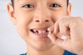 Little boy showing baby teeth toothless close up waiting for new teeth Royalty Free Stock Photo