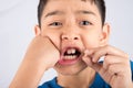 Little boy showing baby teeth toothless close up waiting for new teeth Royalty Free Stock Photo