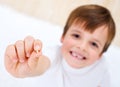 Little boy showing his milk-tooth in his hand