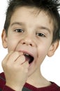 Little boy shows a broken tooth Royalty Free Stock Photo