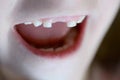 Little Child Smiling Missing Front Tooth Royalty Free Stock Photo