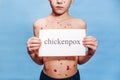 Little cute boy with chickenpox on a blue background holds a tablet with the inscription in his hands. Place for your text. Banner