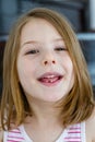 Little cute girl with first lost milk tooth