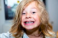 Little funny girl with retainer Royalty Free Stock Photo