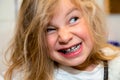 Little funny girl with retainer Royalty Free Stock Photo