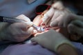 Little Girl on Dentist Chair, Kid is taking Dental Procedure