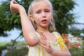 Little girl. Elbow wound. fell in the park on a walk, shows a wound and cries