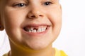 Little girl face smiling showing missing front baby tooth looking away on white background. First teeth changing going Royalty Free Stock Photo