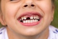 Little girl fell a baby tooth. Child's mouth with hole between the teeth Royalty Free Stock Photo