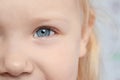 Little girl, focus on eye. Visiting children`s doctor Royalty Free Stock Photo