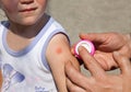 Little girl with mosquito bite on arm Royalty Free Stock Photo