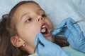 Little girl with open mouth sitting in the dentist`s chair