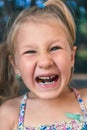 Little girl with orthodontics appliance and crooked teeth. Wobbly tooth