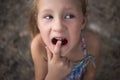 Little girl points the finger at a wobbly baby tooth