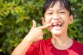 Little girl showing her broken milk teeth Royalty Free Stock Photo