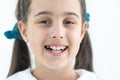 little girl showing her healthy teeth at dental office, smiling and waiting for a checkup. Early prevention Royalty Free Stock Photo